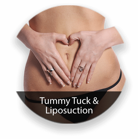 Tummy Tuck and Liposuction Service